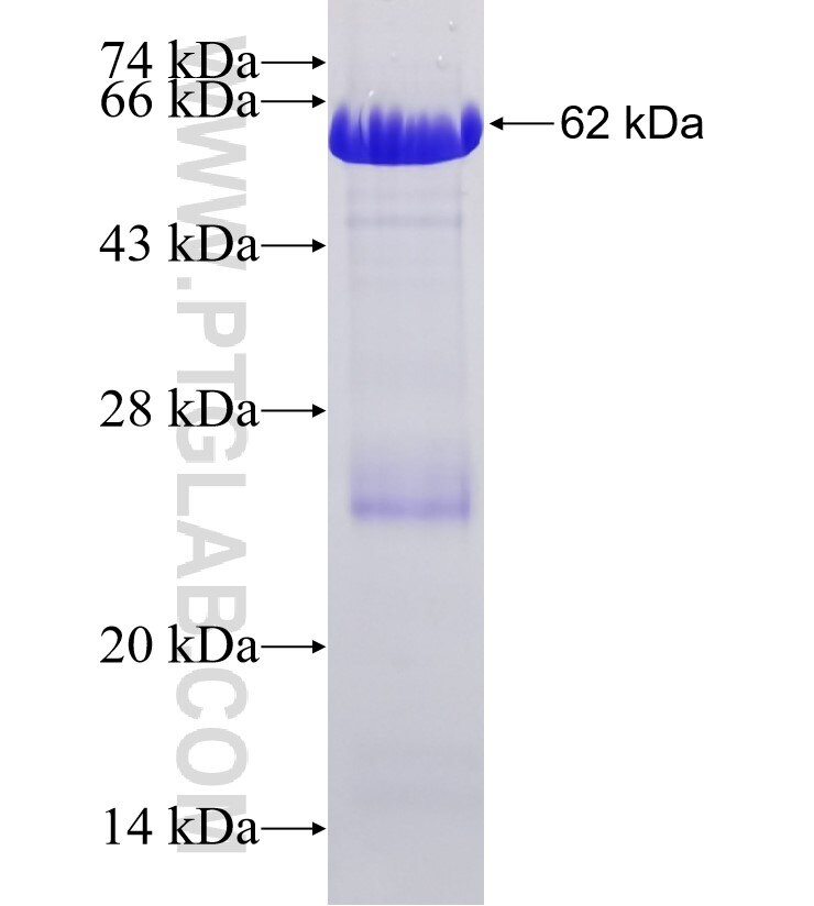 AKAP12 fusion protein Ag32851 SDS-PAGE