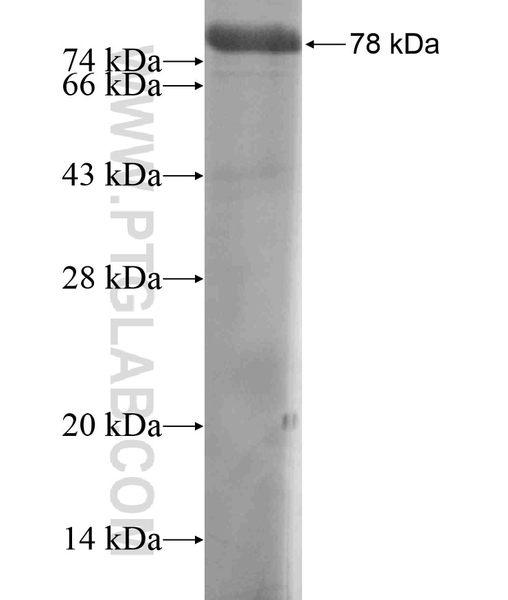 AKAP12 fusion protein Ag17769 SDS-PAGE