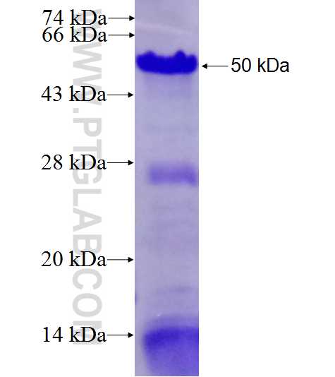 AKAP13 fusion protein Ag27500 SDS-PAGE AKAP13 fusion protein Ag27500 SDS-PAGE