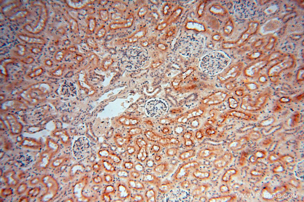 Immunohistochemistry (IHC) staining of human kidney tissue using AKAP14 Polyclonal antibody (14622-1-AP)