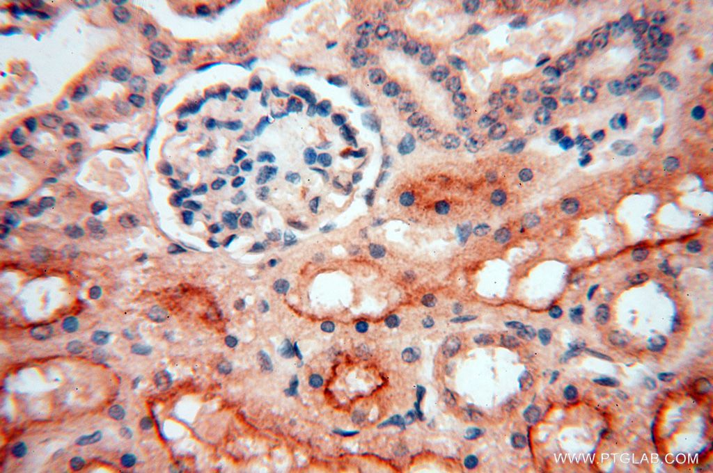 Immunohistochemistry (IHC) staining of human kidney tissue using AKAP14 Polyclonal antibody (14622-1-AP)
