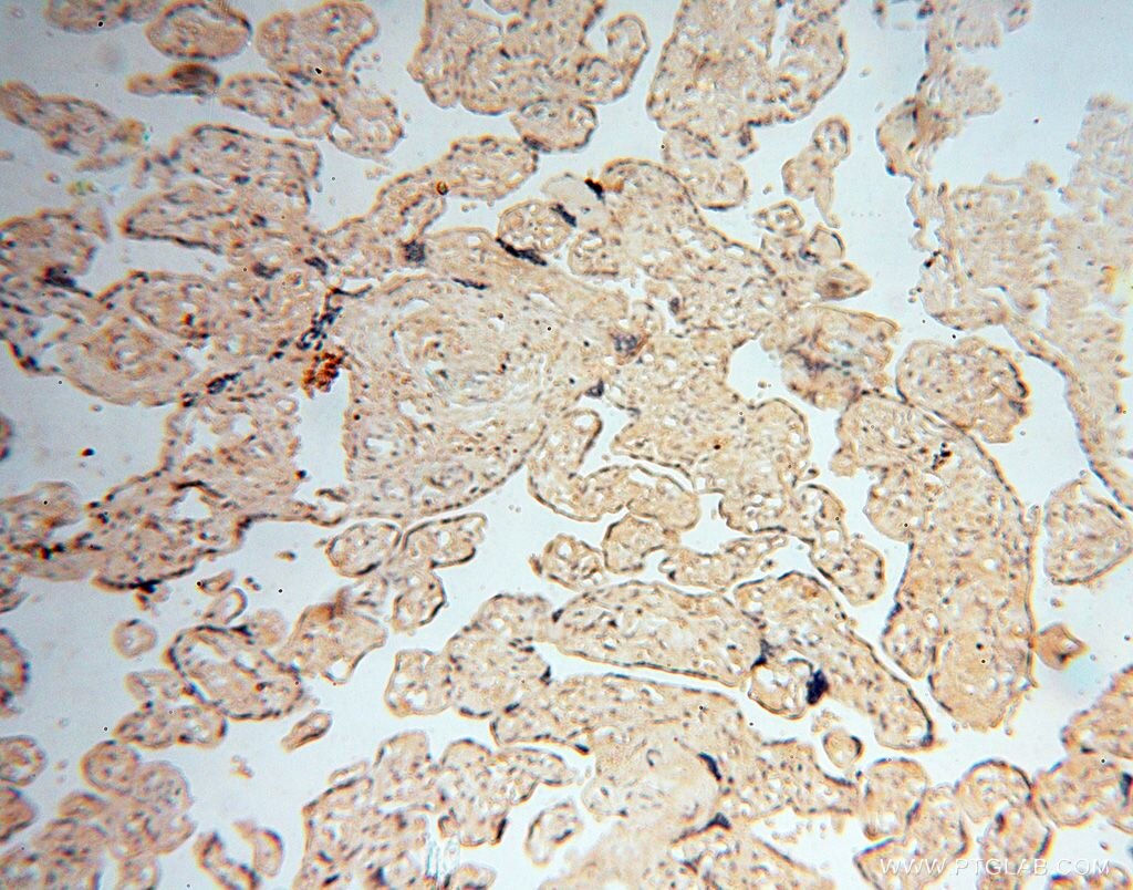 Immunohistochemistry (IHC) staining of human placenta tissue using AKAP14 Polyclonal antibody (14622-1-AP)