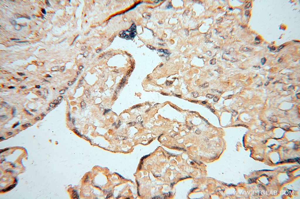 Immunohistochemistry (IHC) staining of human placenta tissue using AKAP14 Polyclonal antibody (14622-1-AP)