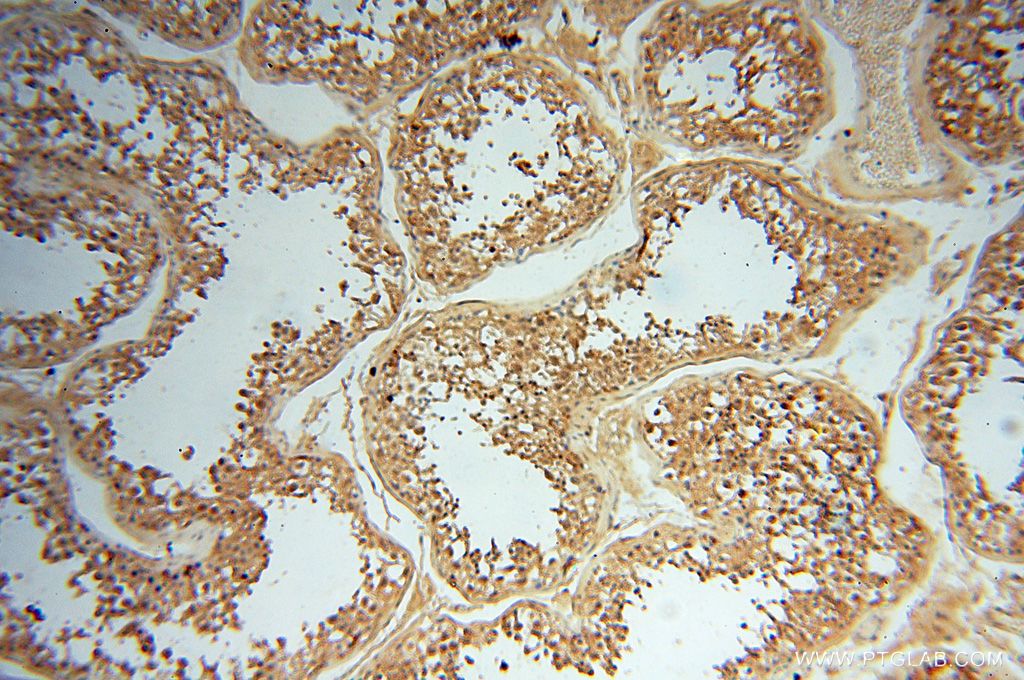 Immunohistochemistry (IHC) staining of human testis tissue using AKAP14 Polyclonal antibody (14622-1-AP)