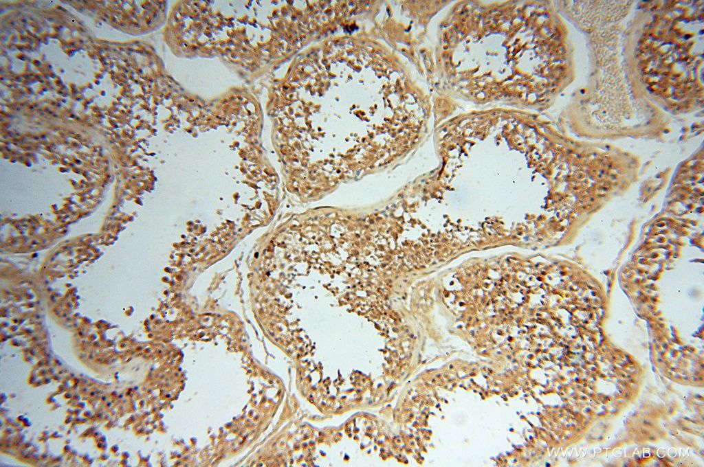 IHC staining of human testis using 14622-1-AP