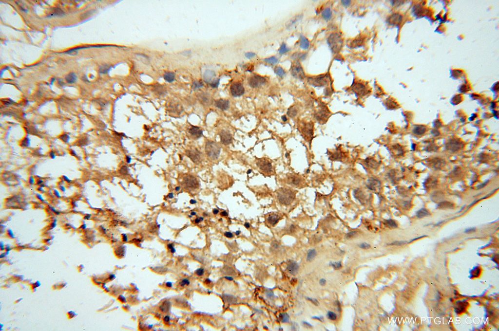 Immunohistochemistry (IHC) staining of human testis tissue using AKAP14 Polyclonal antibody (14622-1-AP)