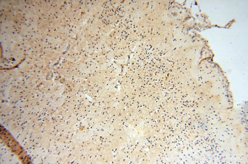 Immunohistochemistry (IHC) staining of human brain tissue using AKAP14 Polyclonal antibody (14622-1-AP)