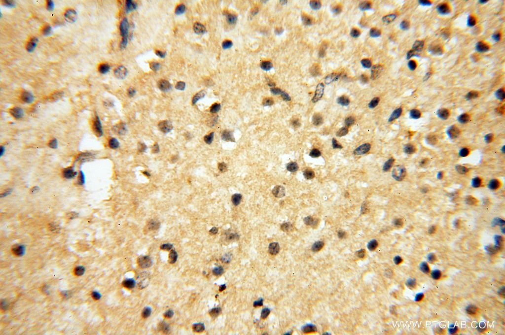Immunohistochemistry (IHC) staining of human brain tissue using AKAP14 Polyclonal antibody (14622-1-AP)
