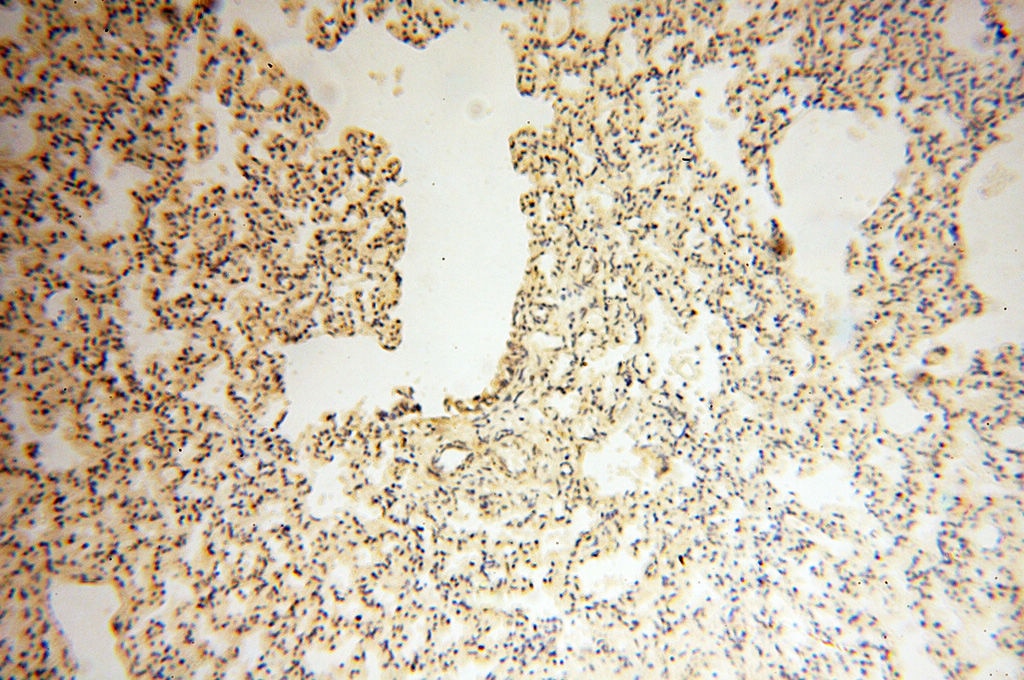Immunohistochemistry (IHC) staining of human lung tissue using AKAP14 Polyclonal antibody (14622-1-AP)