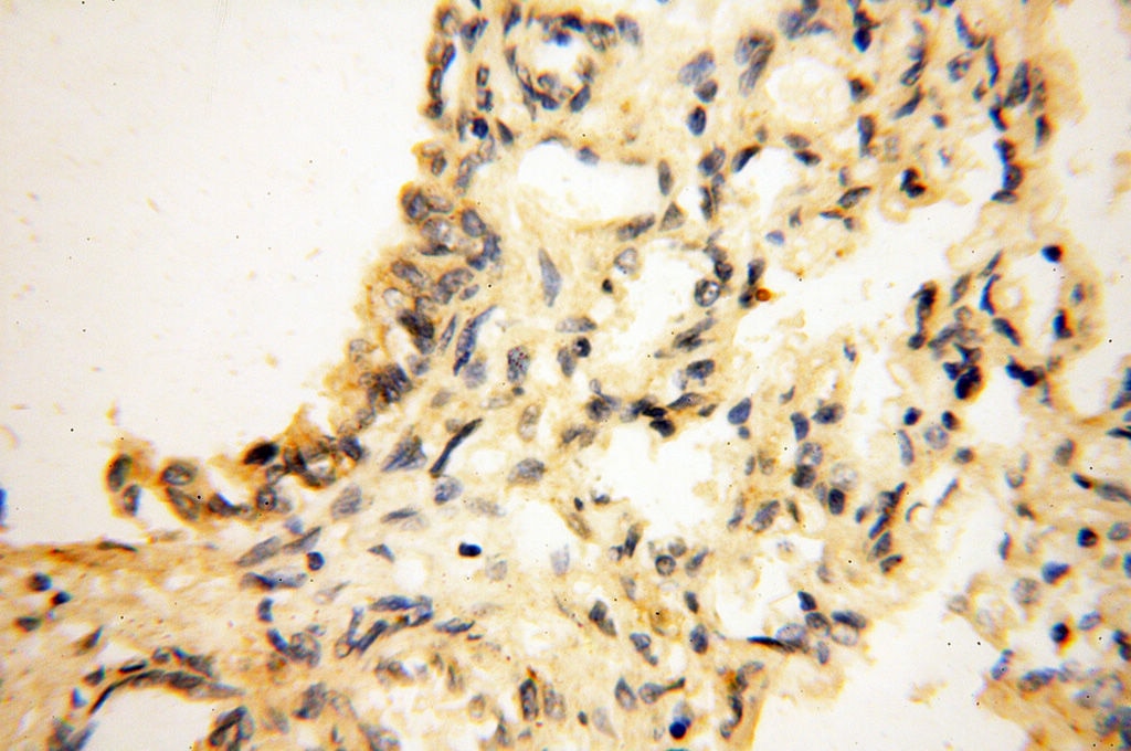 Immunohistochemistry (IHC) staining of human lung tissue using AKAP14 Polyclonal antibody (14622-1-AP)