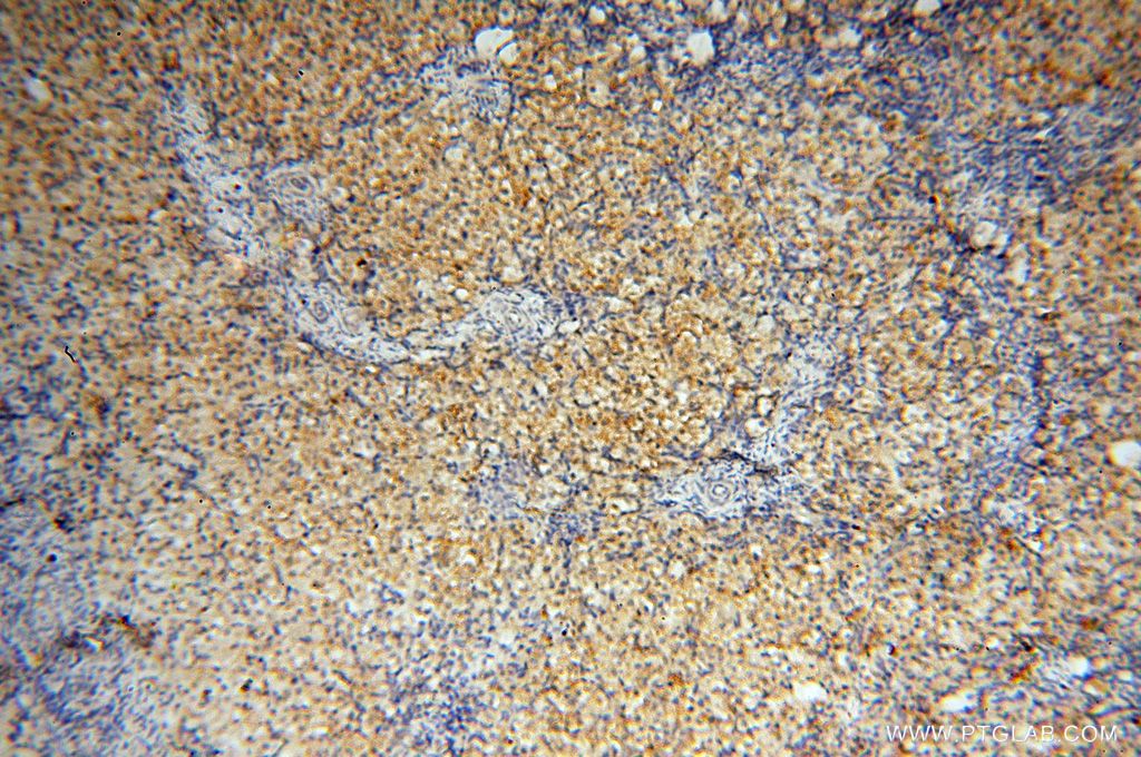 Immunohistochemistry (IHC) staining of human ovary tissue using AKAP14 Polyclonal antibody (14622-1-AP)