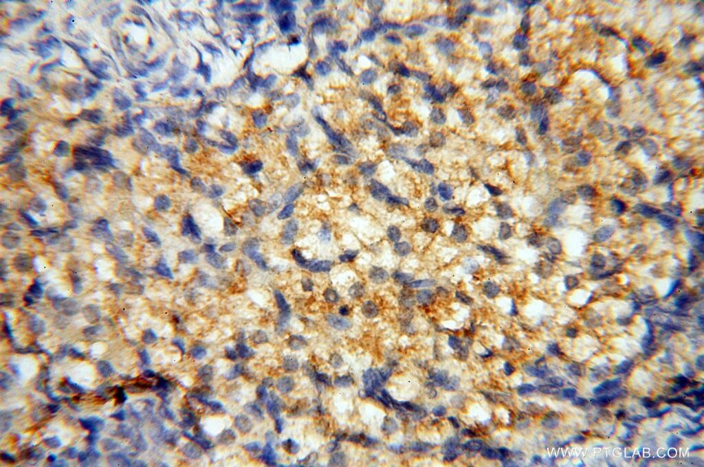 Immunohistochemistry (IHC) staining of human ovary tissue using AKAP14 Polyclonal antibody (14622-1-AP)
