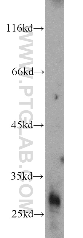 Western Blot (WB) analysis of human testis tissue using AKAP14 Polyclonal antibody (14622-1-AP)