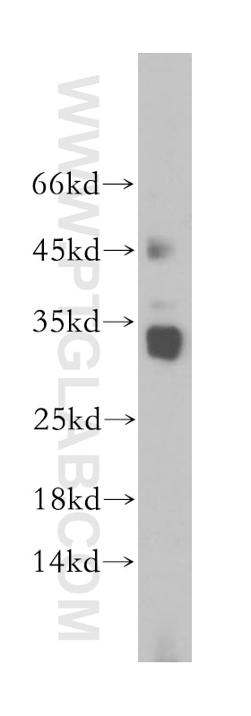 Western Blot (WB) analysis of Jurkat cells using AKAP14 Polyclonal antibody (14622-1-AP)
