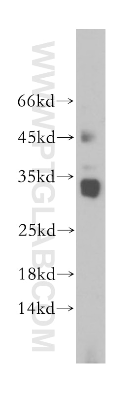 WB analysis of Jurkat using 14622-1-AP