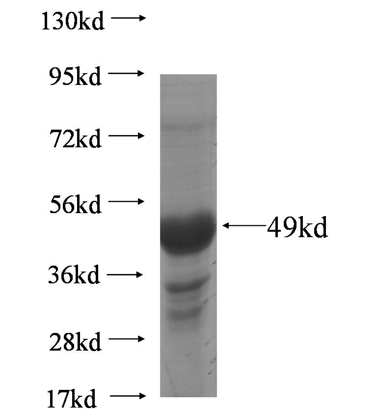AKAP14 fusion protein Ag6255 SDS-PAGE