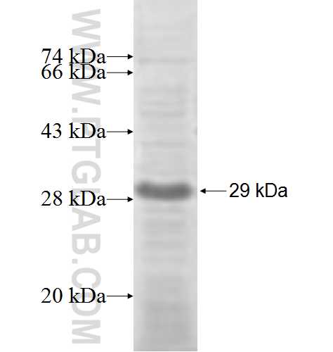AKAP14 fusion protein Ag6376 SDS-PAGE