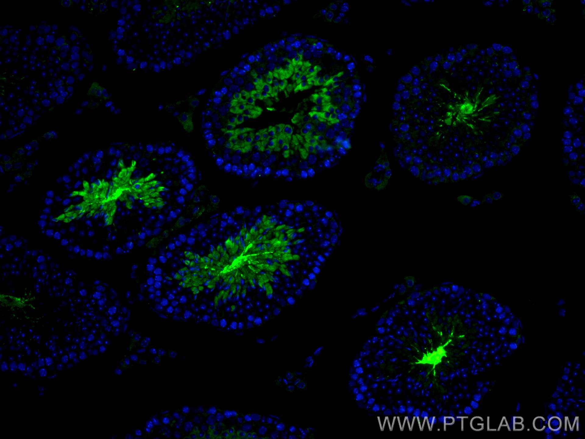 IF Staining of mouse testis using 13907-1-AP