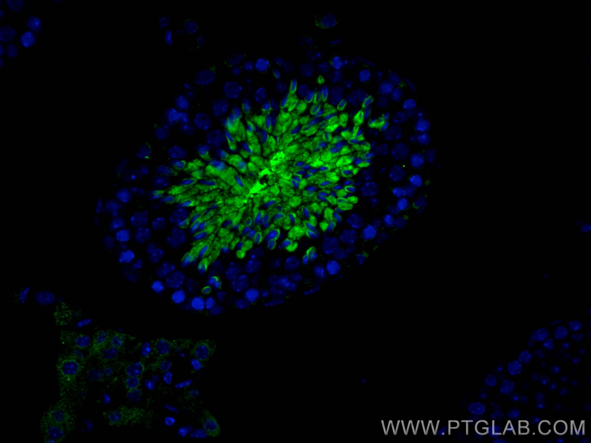 IF Staining of mouse testis using 13907-1-AP