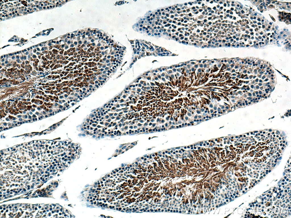 Immunohistochemistry (IHC) staining of mouse testis tissue using AKAP3 Polyclonal antibody (13907-1-AP)