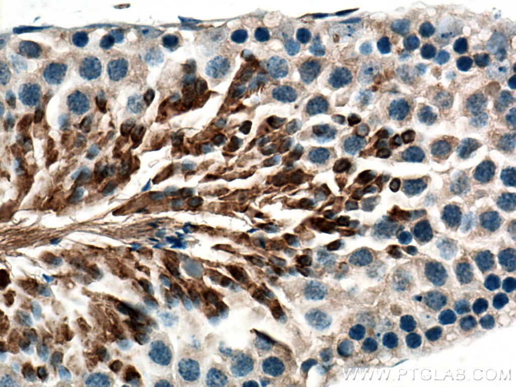 Immunohistochemistry (IHC) staining of mouse testis tissue using AKAP3 Polyclonal antibody (13907-1-AP)