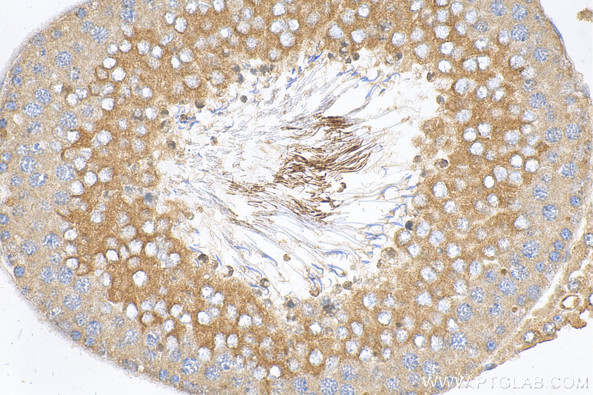 Immunohistochemistry (IHC) staining of rat testis tissue using AKAP3 Polyclonal antibody (13907-1-AP)