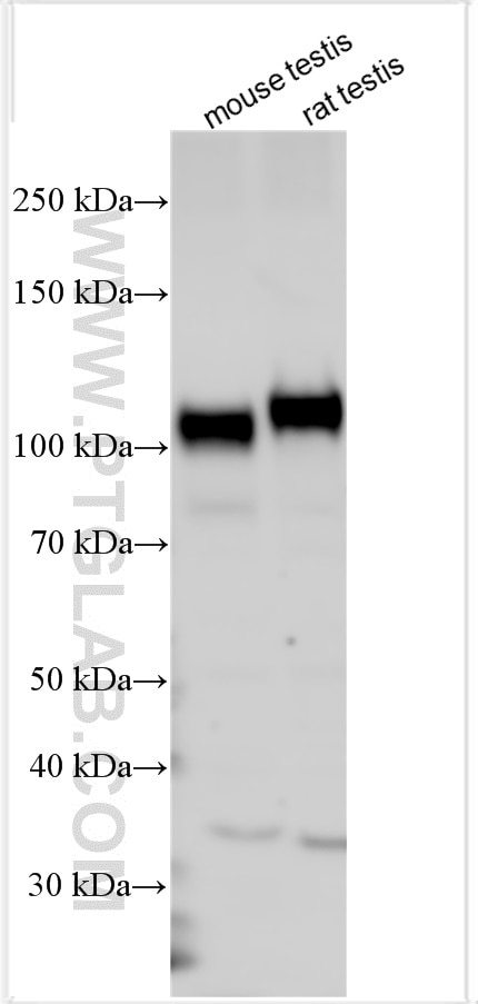 Western Blot (WB) analysis of various lysates using AKAP3 Polyclonal antibody (13907-1-AP)