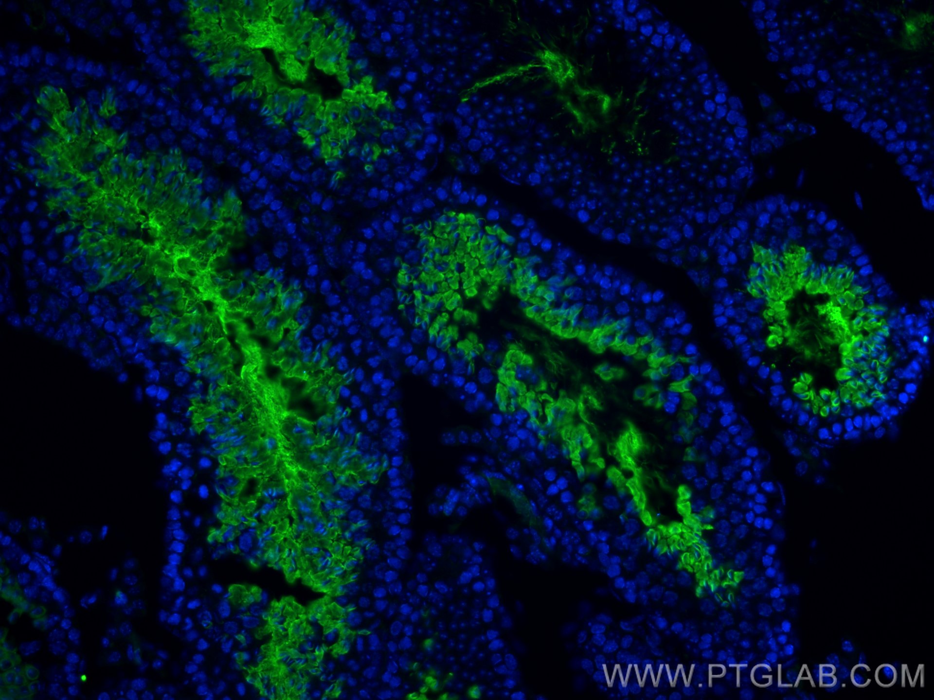 Immunofluorescence (IF) / fluorescent staining of mouse testis tissue using AKAP3 Monoclonal antibody (66255-1-Ig)