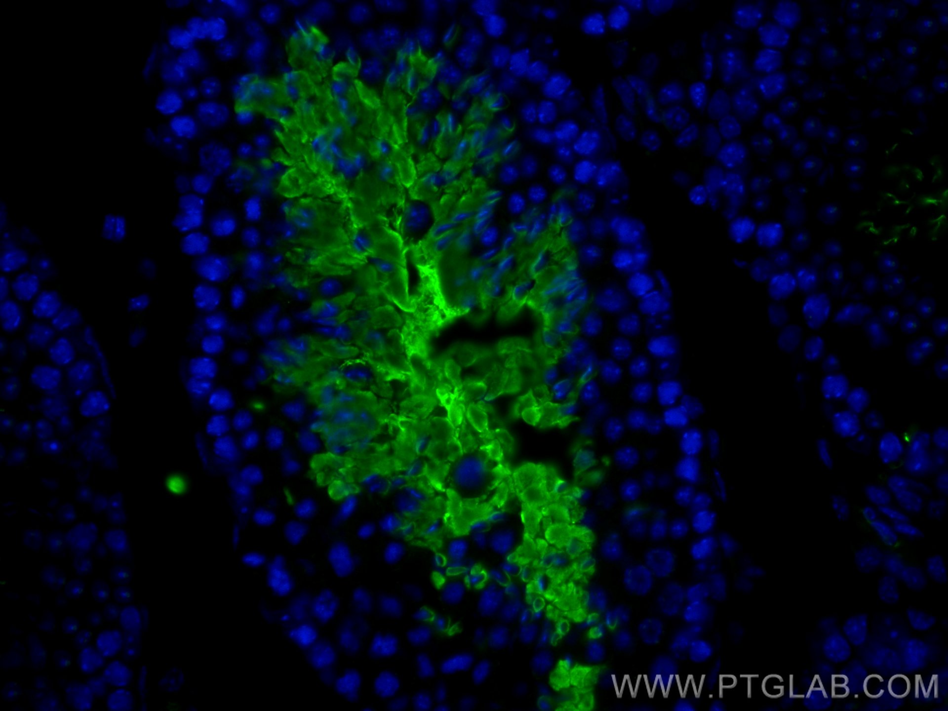 Immunofluorescence (IF) / fluorescent staining of mouse testis tissue using AKAP3 Monoclonal antibody (66255-1-Ig)