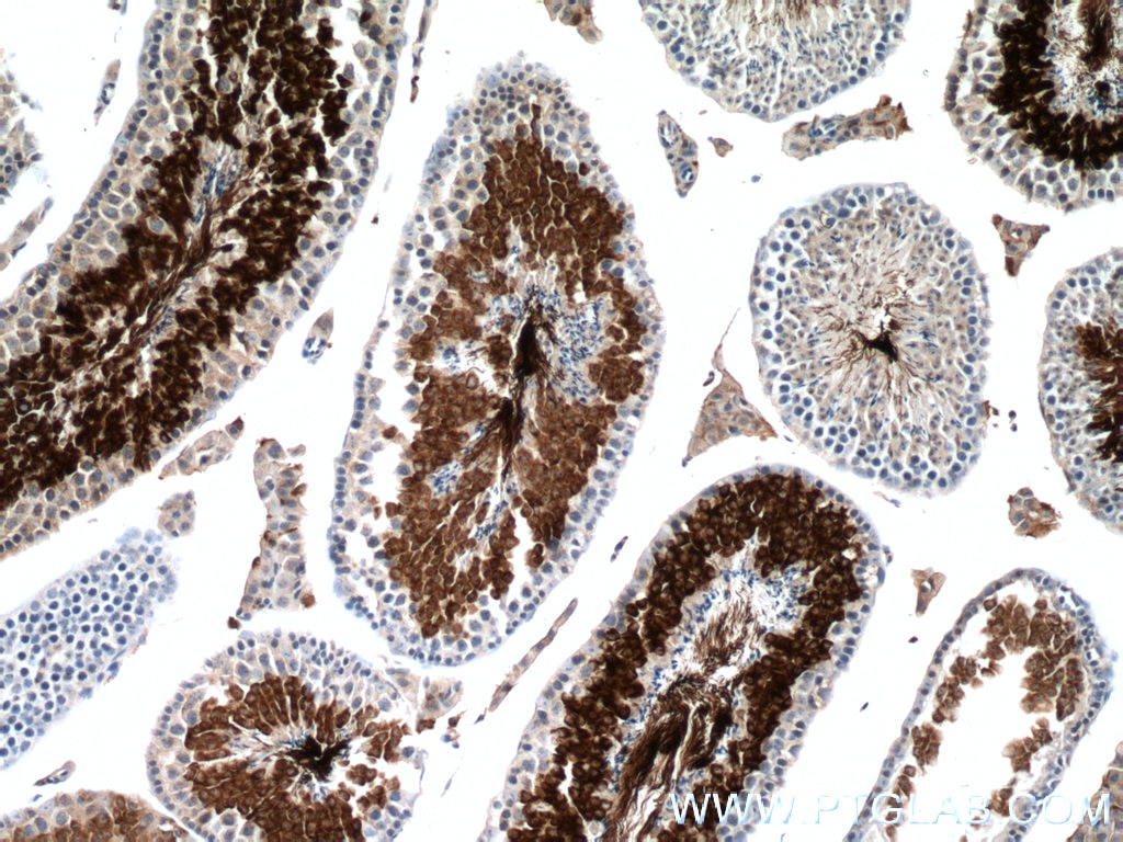 Immunohistochemistry (IHC) staining of mouse testis tissue using AKAP3 Monoclonal antibody (66255-1-Ig)