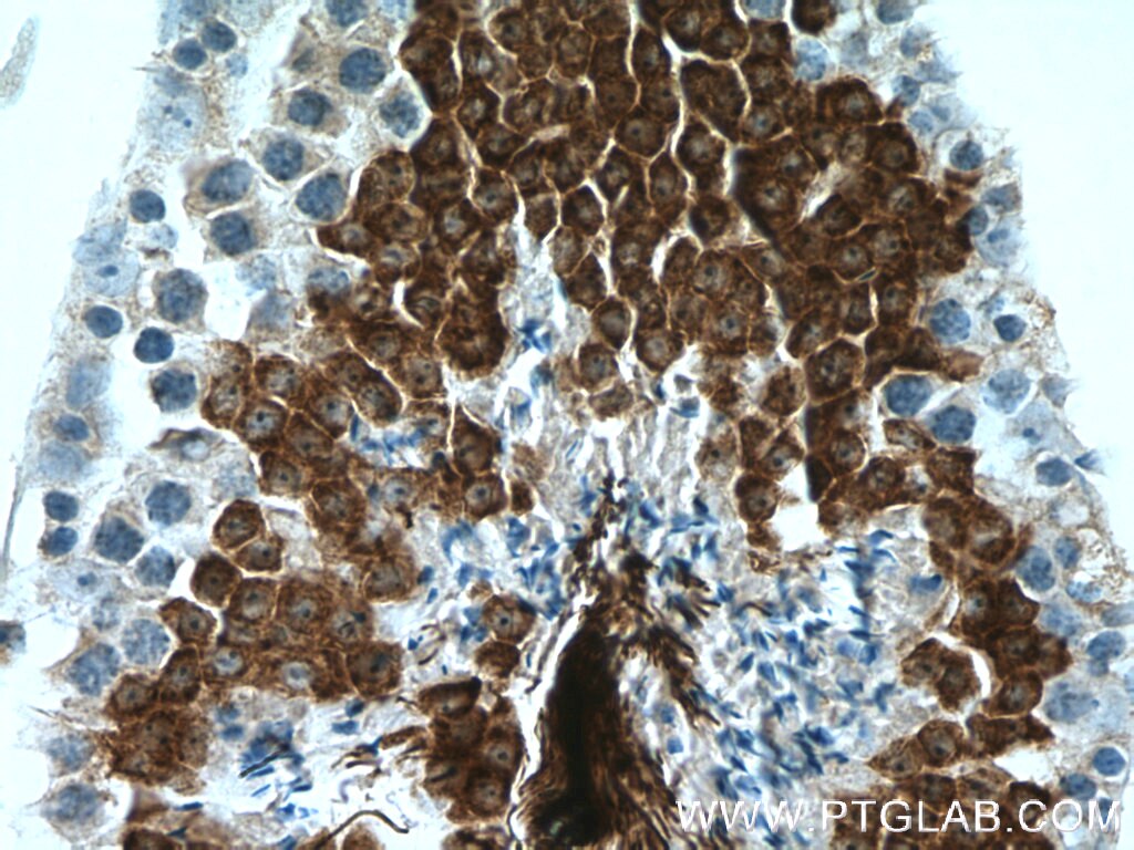Immunohistochemistry (IHC) staining of mouse testis tissue using AKAP3 Monoclonal antibody (66255-1-Ig)