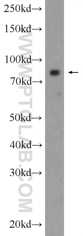 Western Blot (WB) analysis of human testis tissue using AKAP4 Polyclonal antibody (24986-1-AP)