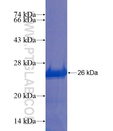 AKAP4 fusion protein Ag21762 SDS-PAGE