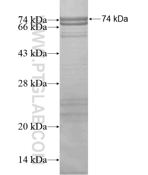 AKAP5 fusion protein Ag19162 SDS-PAGE