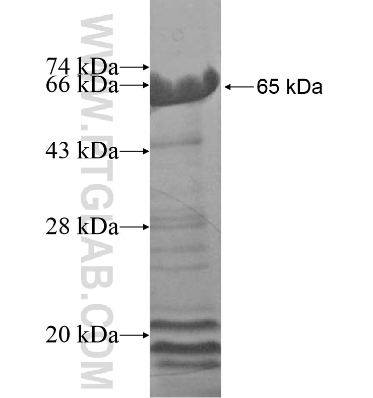 AKAP6 fusion protein Ag16181 SDS-PAGE