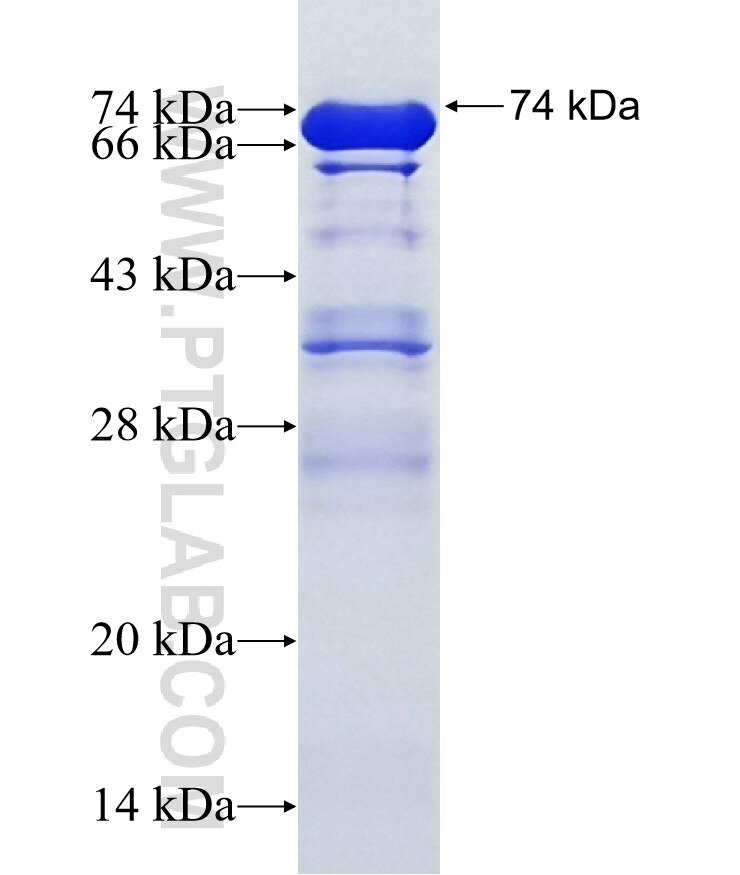 AKAP6 fusion protein Ag15749 SDS-PAGE