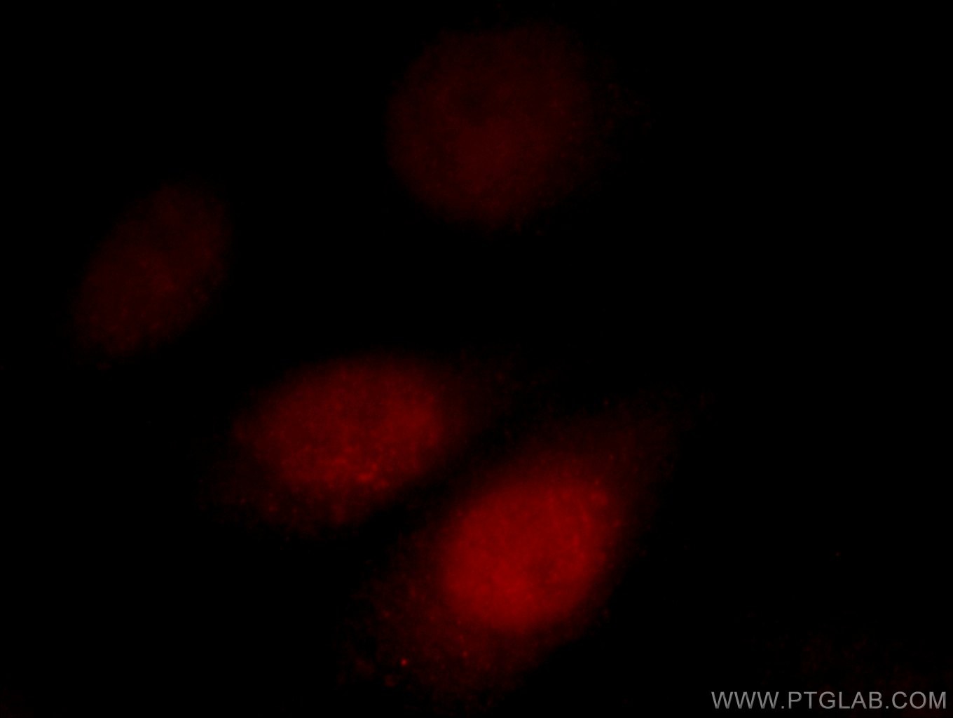 IF Staining of HepG2 using 12591-1-AP