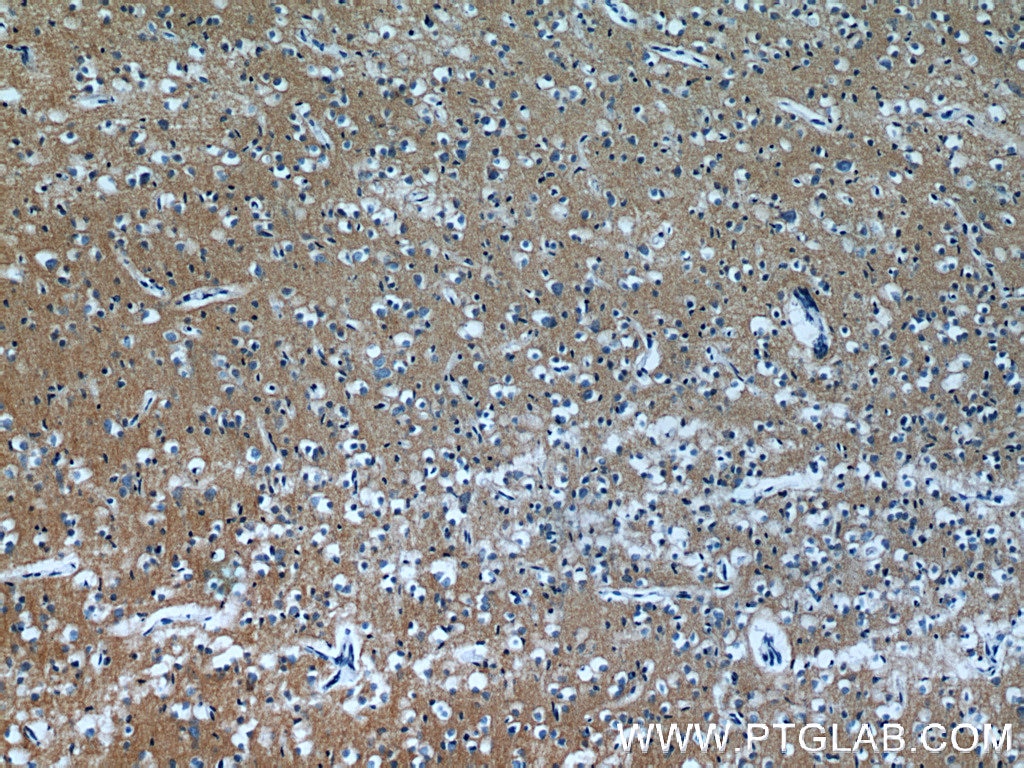 Immunohistochemistry (IHC) staining of human brain tissue using AKAP7 Polyclonal antibody (12591-1-AP)