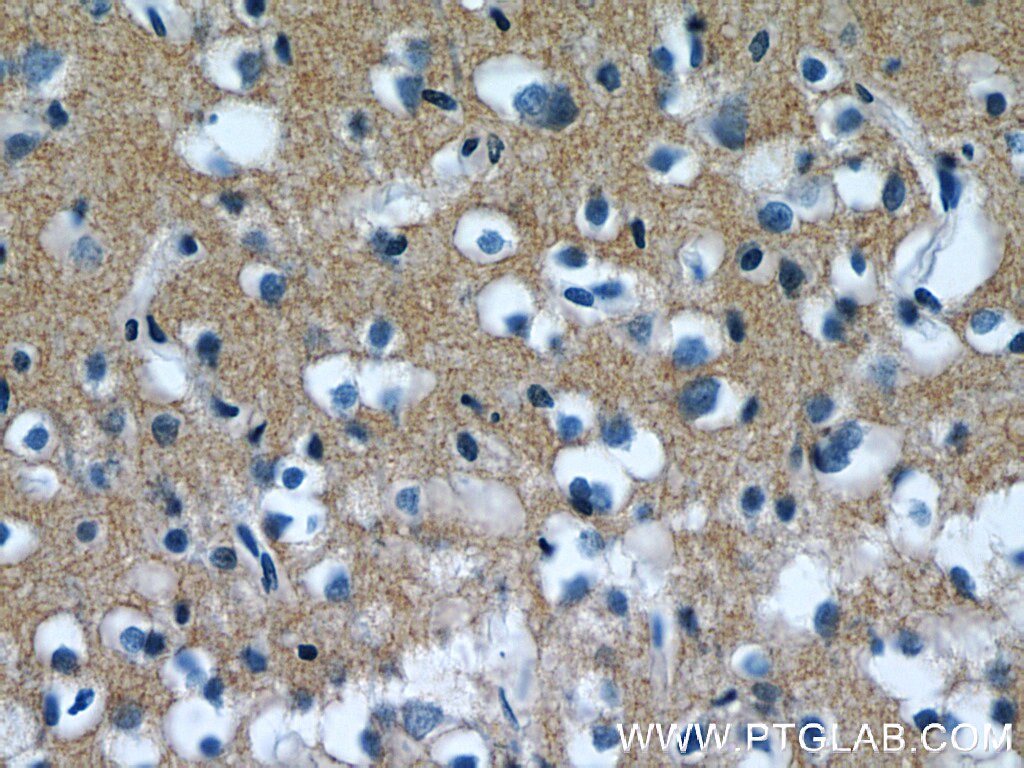 IHC staining of human brain using 12591-1-AP