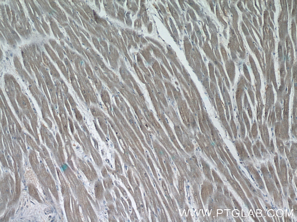 Immunohistochemistry (IHC) staining of human heart tissue using AKAP7 Polyclonal antibody (12591-1-AP)