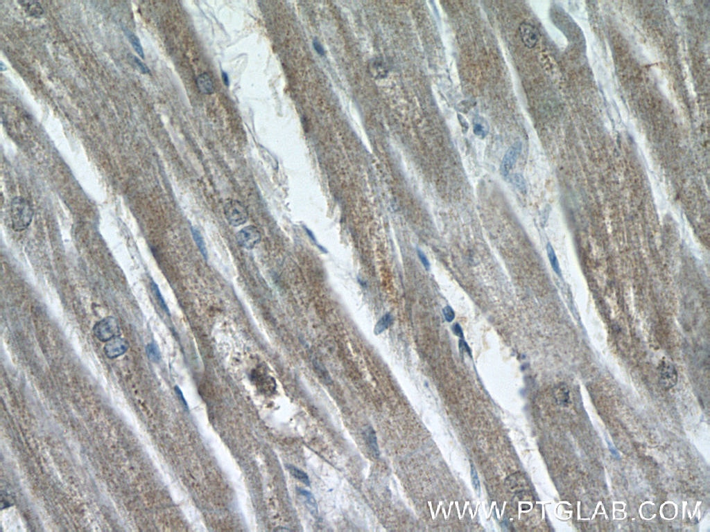 Immunohistochemistry (IHC) staining of human heart tissue using AKAP7 Polyclonal antibody (12591-1-AP)