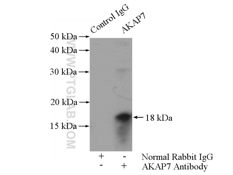 Immunoprecipitation (IP) experiment of mouse brain tissue using AKAP7 Polyclonal antibody (12591-1-AP)