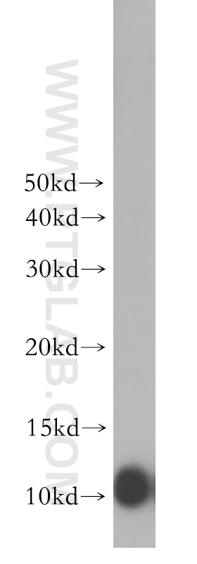 Western Blot (WB) analysis of human brain tissue using AKAP7 Polyclonal antibody (12591-1-AP)