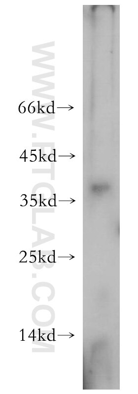 Western Blot (WB) analysis of human heart tissue using AKAP7 Polyclonal antibody (12591-1-AP)
