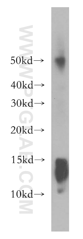 Western Blot (WB) analysis of human brain tissue using AKAP7 Polyclonal antibody (12591-1-AP)