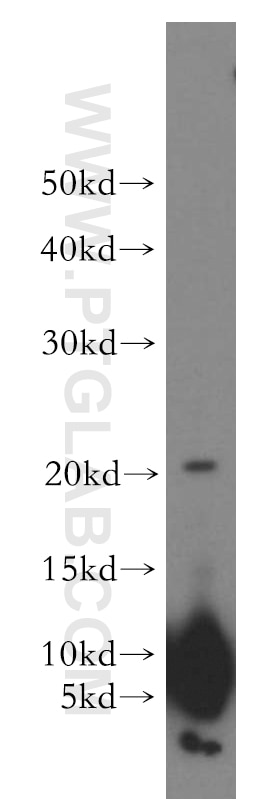 Western Blot (WB) analysis of human brain tissue using AKAP7 Polyclonal antibody (12591-1-AP)