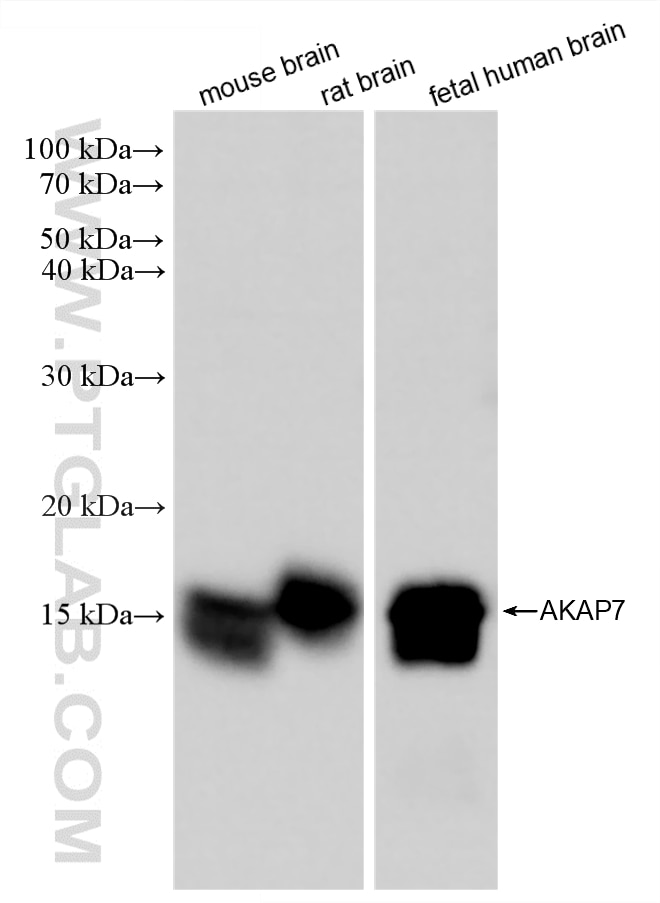 WB analysis using 88409-2-RR (same clone as 88409-2-PBS) Western Blot (WB) analysis of various lysates using AKAP7 Recombinant monoclonal antibody (88409-2-RR)