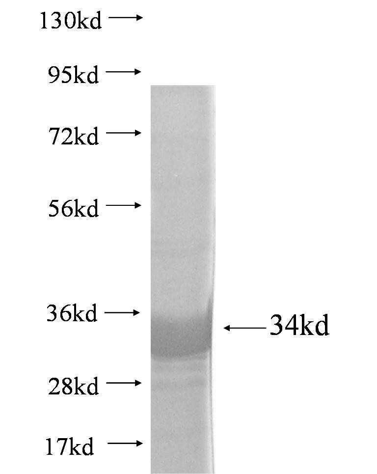 AKAP7 fusion protein Ag3297 SDS-PAGE