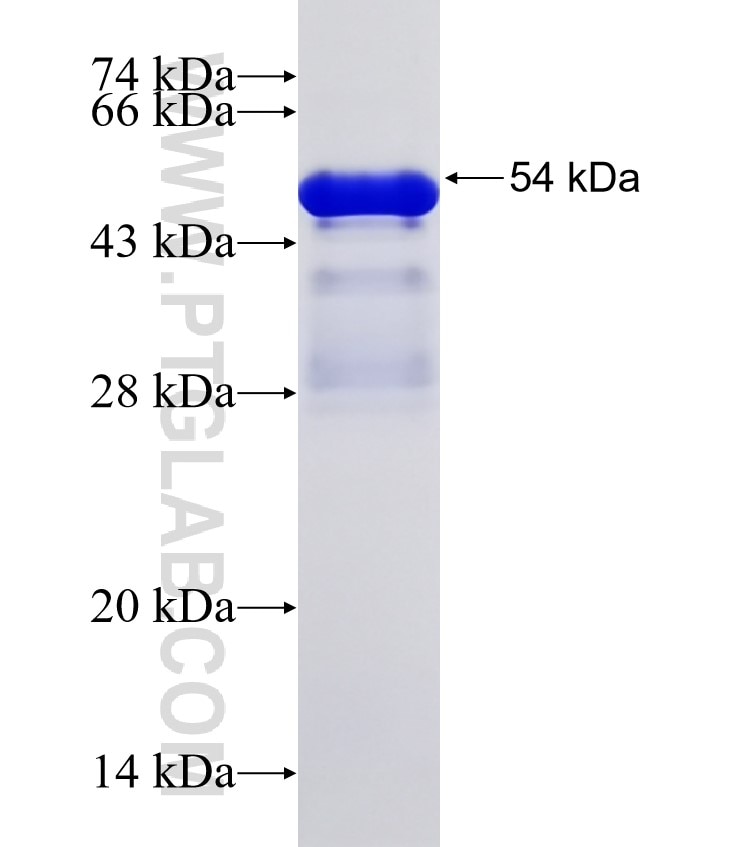 AKAP9 fusion protein Ag32425 SDS-PAGE