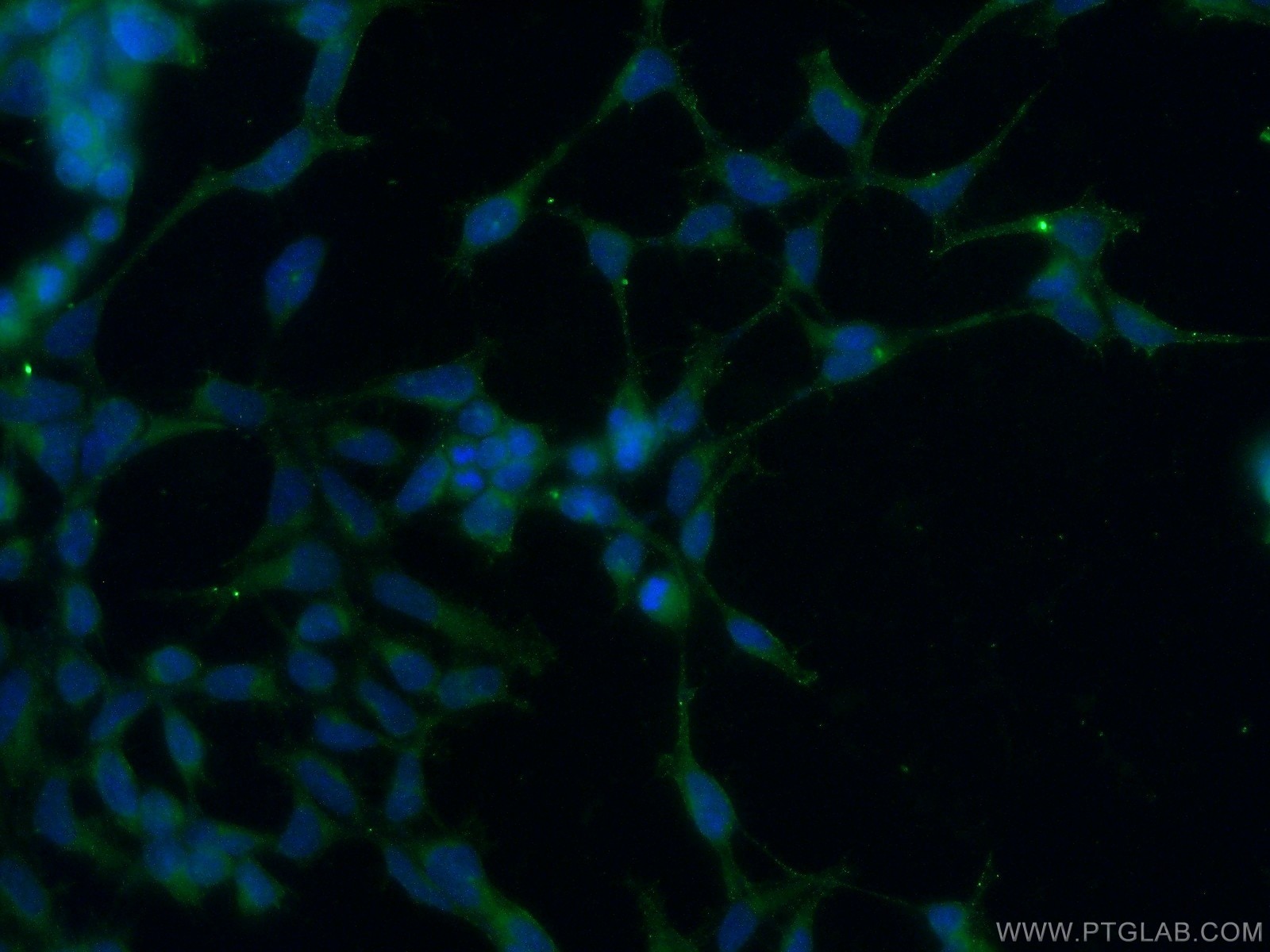 Immunofluorescence (IF) / fluorescent staining of HEK-293 cells using AKD1 Polyclonal antibody (23042-1-AP)